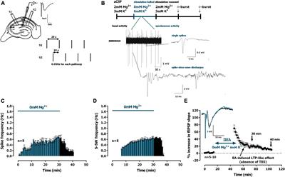 Epileptiform activity influences theta-burst induced LTP in the adult hippocampus: a role for synaptic lipid raft disruption in early metaplasticity?
